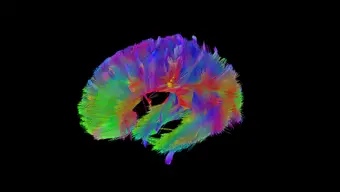 Image of a colorful brain made with the use of tractography