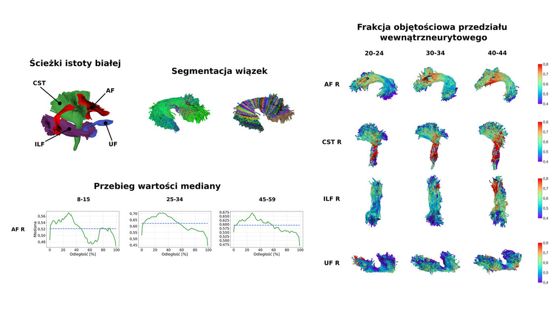 Figure presenting the pathways in the white matter, the segmentation of bundles, etc. 