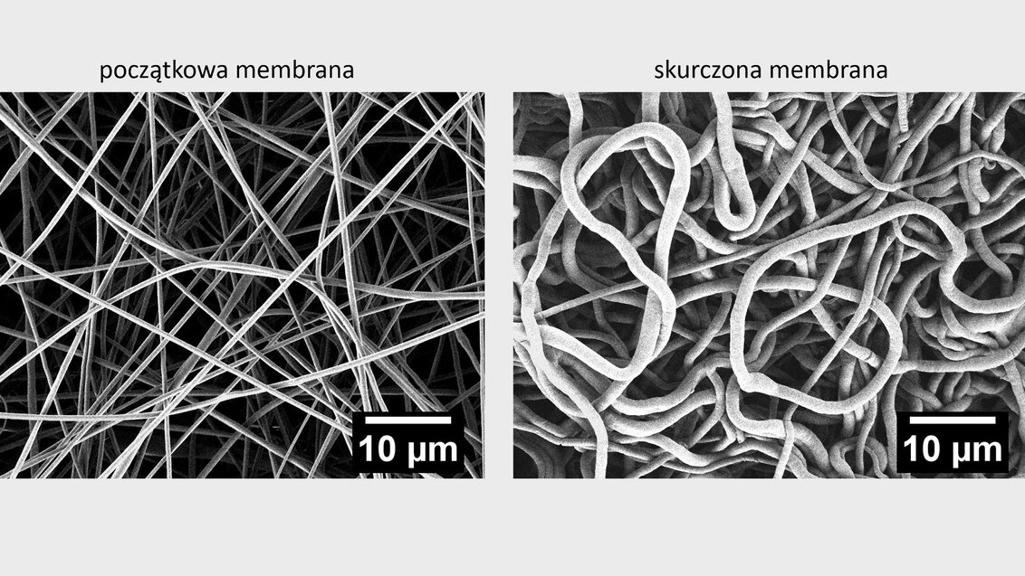 Mikroskopowe obrazy membrany początkowej i skurczonej. na pierwszym obrazie włókna są proste i luźne, na drugim zpętlone i zacieśnione.