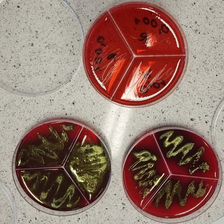 Three red Petri dishes with different samples.