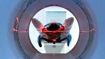 Mężczyna leżący na plecach z rękami założonymi pod głowę obserwowany z wnętrzna skanera MRI
