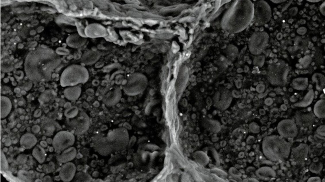 The interior of a doughnut with +400 magnification. This level of magnification renders the bubbly structure of the doughnut grey and white.