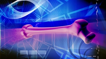 In the middle of the picture, there is a visualisation of a thigh bone in purple. The bone is represented on a navy blue background with blue squares sketched in the distance and a grid of parallel and perpendicular lines.